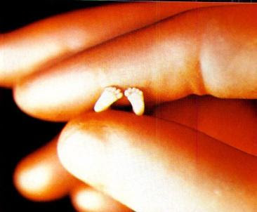 Feet of 10-week-old fetus unborn baby in fingers